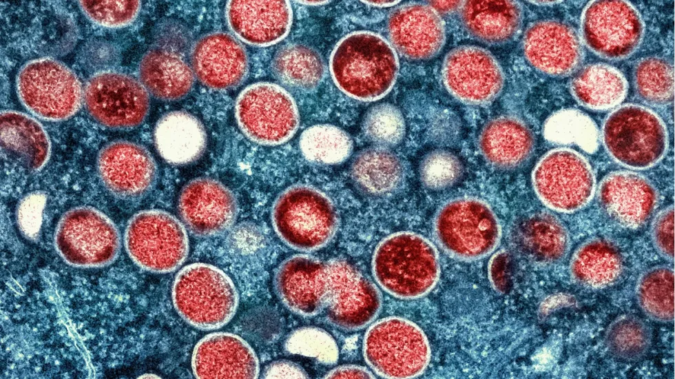 monkeypox mpox